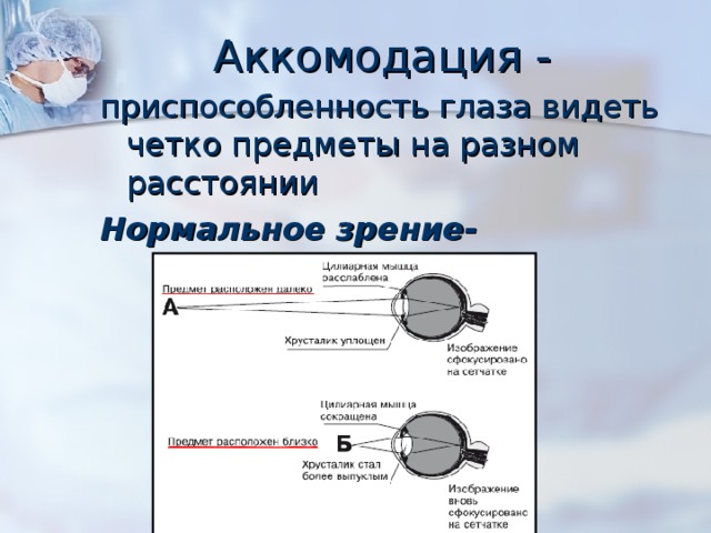Аккомодация - приспособленность глаза видеть четко предметы на разном расстоянии Нормальное зрение- 