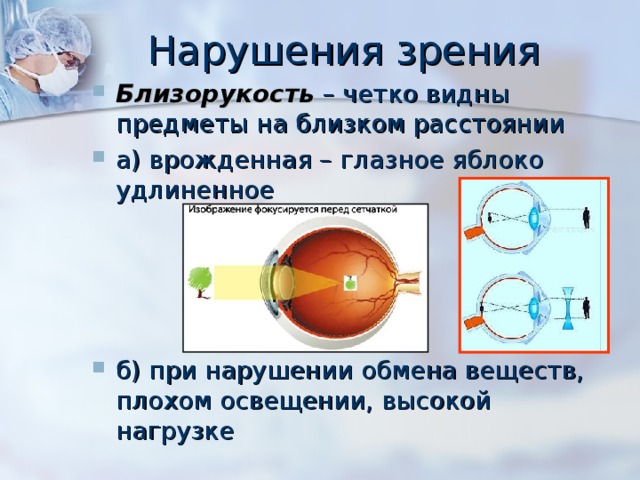 Нарушения зрения Близорукость – четко видны предметы на близком расстоянии а) врожденная – глазное яблоко удлиненное     б) при нарушении обмена веществ, плохом освещении, высокой нагрузке 