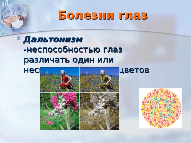 Болезни глаз Дальтонизм -неспособностью глаз различать один или несколько основных цветов 