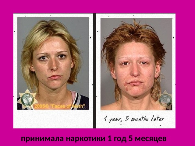  принимала наркотики 1 год 5 месяцев 