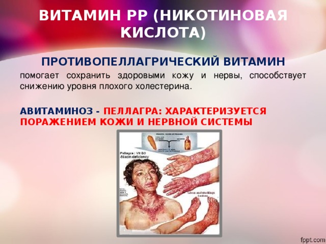 ВИТАМИН РР (НИКОТИНОВАЯ КИСЛОТА) ПРОТИВОПЕЛЛАГРИЧЕСКИЙ ВИТАМИН помогает сохранить здоровыми кожу и нервы, способствует снижению уровня плохого холестерина. АВИТАМИНОЗ - ПЕЛЛАГРА: ХАРАКТЕРИЗУЕТСЯ ПОРАЖЕНИЕМ КОЖИ И НЕРВНОЙ СИСТЕМЫ   