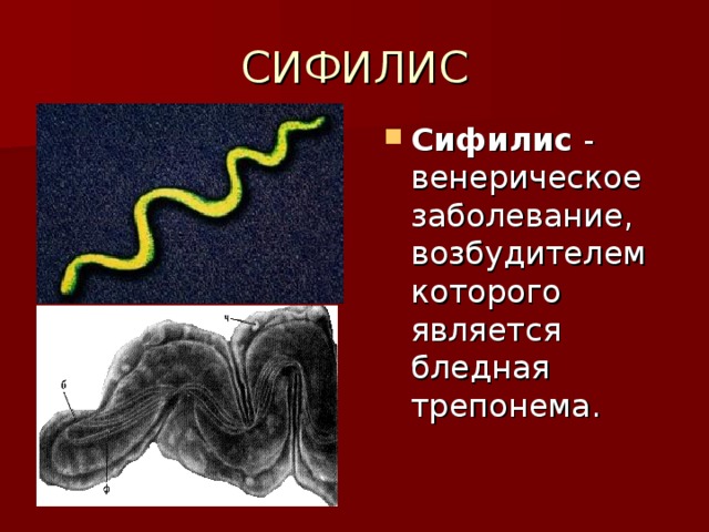 СИФИЛИС Сифилис - венерическое заболевание, возбудителем которого является бледная трепонема. 