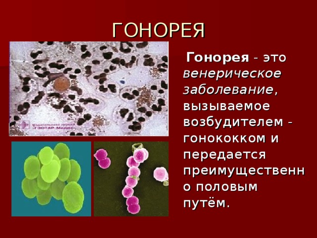 ГОНОРЕЯ  Гонорея - это венерическое заболевание , вызываемое возбудителем - гонококком и передается преимущественно половым путём. 