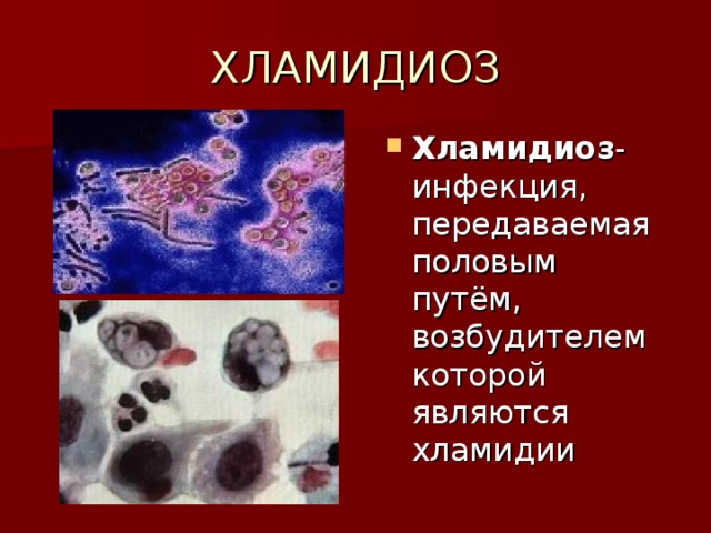 ХЛАМИДИОЗ Хламидиоз - инфекция, передаваемая половым путём, возбудителем которой являются хламидии 