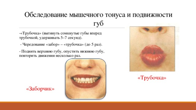 Обследование мышечного тонуса и подвижности губ -«Трубочка» (вытянуть сомкнутые губы вперед трубочкой, удерживать 5–7 секунд).   - Чередование «забор» – «трубочка» (до 5 раз). - Поднять верхнюю губу, опустить нижнюю губу, повторить движения несколько раз. «Трубочка» «Заборчик» 