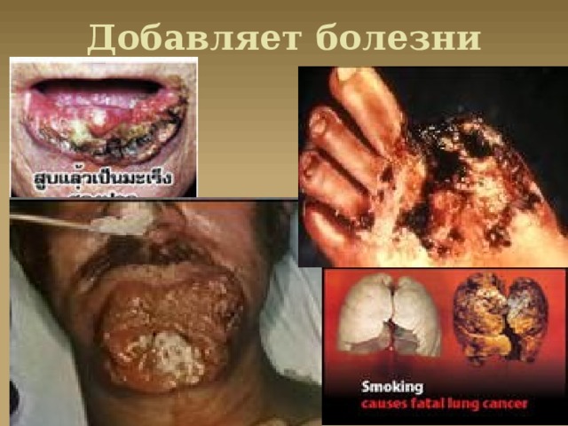 Добавляет болезни 