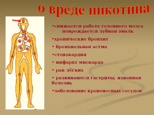 снижается работа головного мозга  повреждается зубная эмаль хронические бронхит  бронхиальная астма стенокардия  инфаркт миокарда  рак лёгких  развиваются гастриты, язвенная болезнь заболевание кровеносных сосудов 